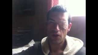 Vlog Eye Problems Mtb Changes And Fab Work