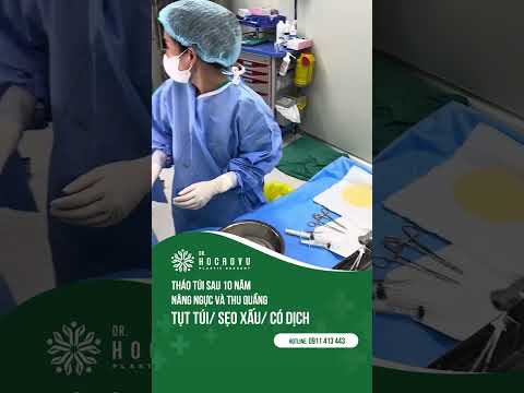 Xử Lý Sẹo Xấu, Tụt Túi và Tụ Dịch Sau 10 Năm Nâng Ngực và Thu Quầng