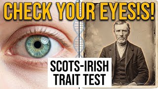 The Scots-Irish Trait Test — Do You Have Any of These