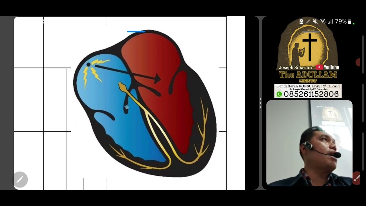Bagaimana Membaca EKG Patologis