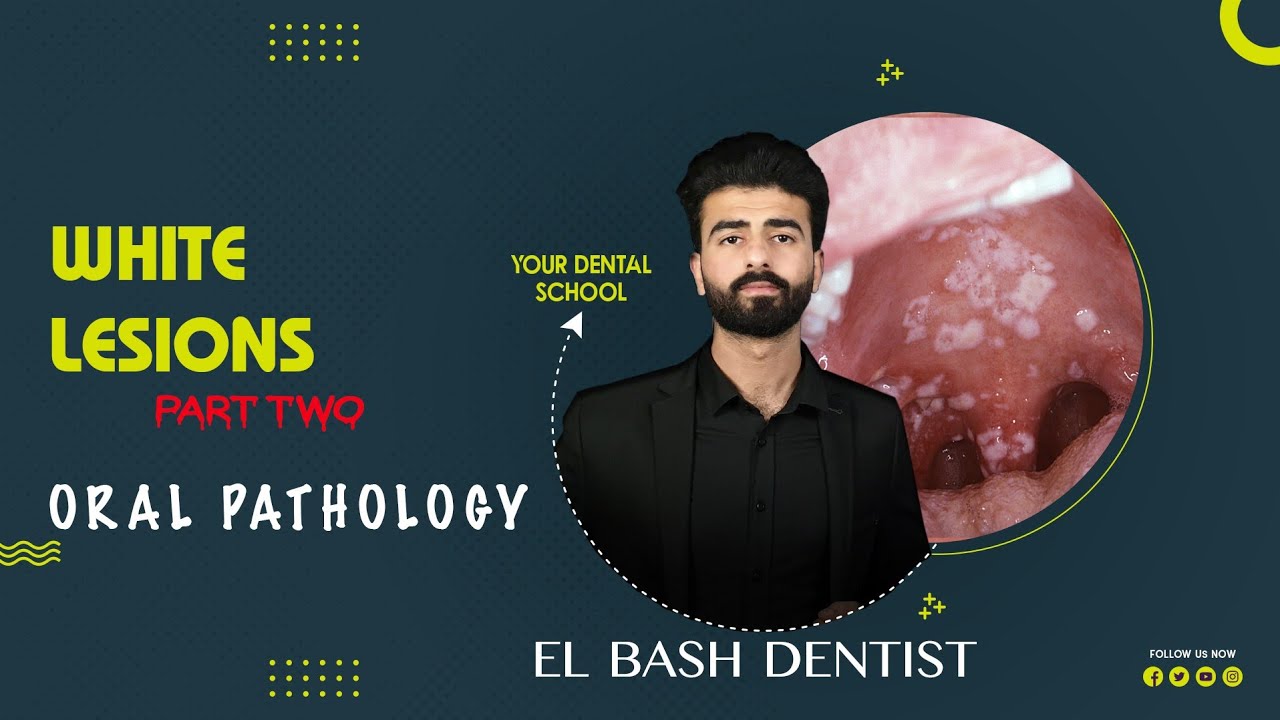 white lesions 