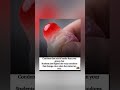Condoms that snitch harder than your group chat. #shorts #viral #trending