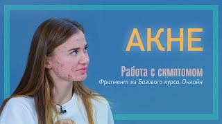 Михаил Филяев | Акне | Базовый курс. Онлайн