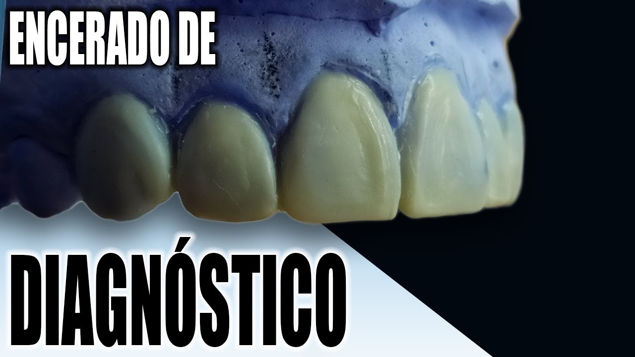 ENCERADO DE DIAGNÓSTICO : Short Clip