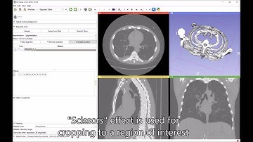 New "scissors" editing tool in 3D Slicer for 3D cropping