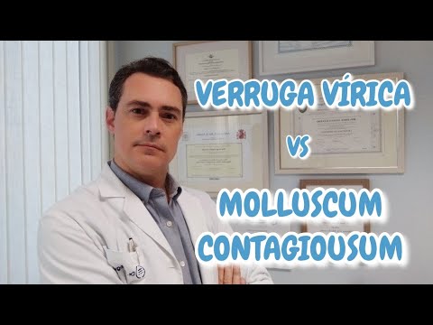 Video: ¿Las verrugas de molusco son contagiosas?