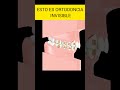 #shortvideo #ortodoncia #ortodonciadigital #ortodonciainvisible #ortodonciaestetica #estetica #boca