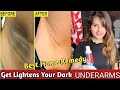 Home Remedy Tips UnderArms Whitening!Rid Dark Spots & Patches! 100%Result!Skincare Tip by Falaknaaz