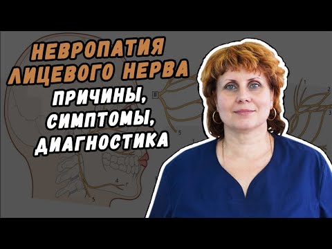 НЕВРОПАТИЯ ЛИЦЕВОГО НЕРВА СИМПТОМЫ, ПРИЧИНЫ, ДИАГНОСТИКА В ХАБАРОВСКЕ