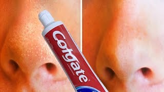 HOW TO GET RID OF BLACKHEADS VASELINE AND TOOTHPASTE COLGATE ||CLEAR SKIN TIPS AND TRICKS