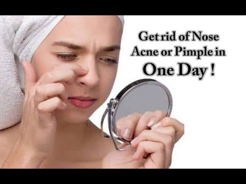 How to get rid of nose pimples fast | Nose acne treatment | Natural and Effective method