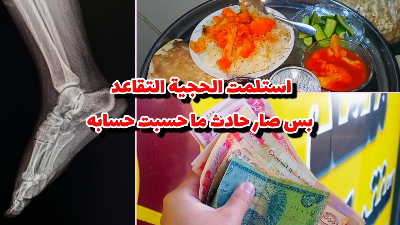 امي وزعت فلوس بعد ما استلمت التقاعد😎صارلي حادث ما توقعته 😳الحمد لله على كل حال 😢 روتين يومي جديد 🌷