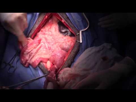 chemotherapy port Live stream pyometra in a labrador