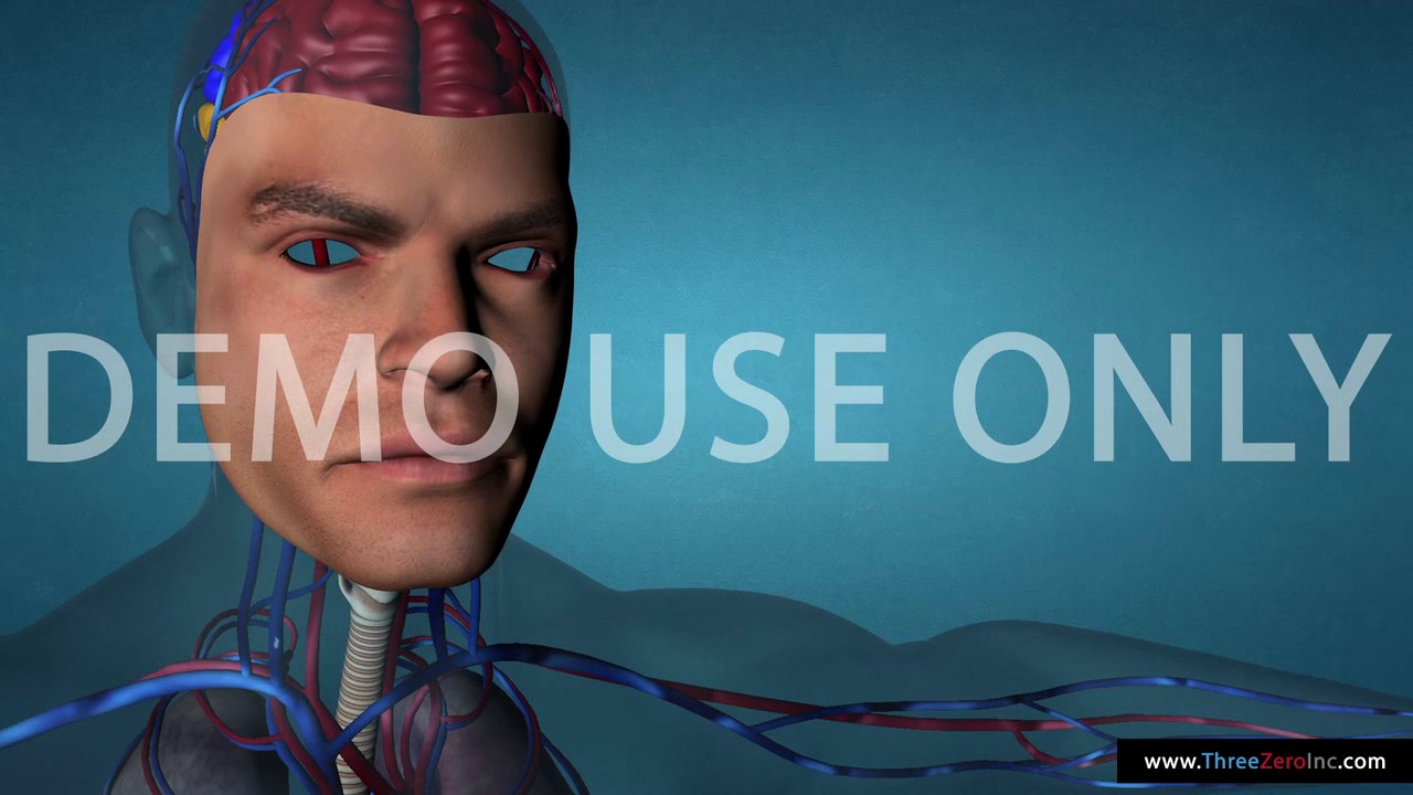 Multi-Gard Blood Purifier: Demo (v3.01) (English)