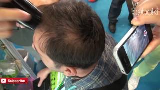✔Смотреть «Пантовигар - Специальный Лекарственный Препарат От Выпадения Волос.» [От Выпадения Волос(, 2016-08-11T14:34:08.000Z)