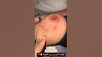 محمد عدنان يتفقد الاصابة 