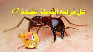 قرصة النملة.....هلى حقا مفيدة للإنسان ؟!!!!