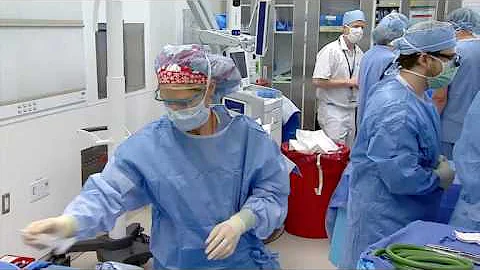 DBS for Stroke Recovery