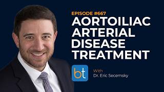 Aortoiliac Arterial Disease Treatment w/ Dr. Eric Secemsky | BackTable Ep. 667