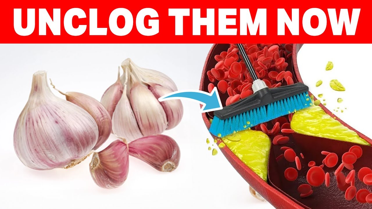The BEST 7 Foods To Remove Your Arteries Plaques YouTube