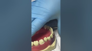 ADC composite cavity preparation task, understanding criteria, part 2