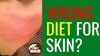 Right Diet for Skin Conditions? : Skin Health Q&A | Ep.1 by Hungry Gopher 56 views 3 weeks ago 8 minutes, 29 seconds