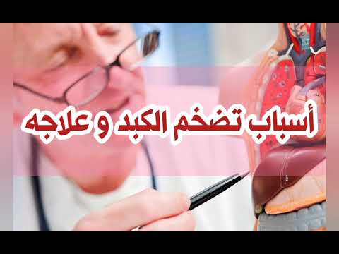 أسباب تضخم الكبد و علاجه ح ٤٢٥ من برنامج معلومةلصحتك بإذاعةالبرنامج العام د محمدعبدالوهاب الأبجيجي