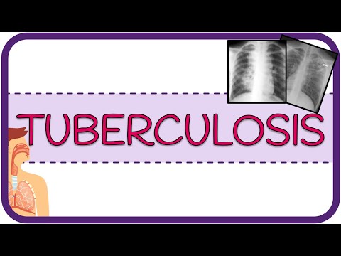 Vídeo: Diferencia Entre Tuberculosis Primaria Y Secundaria