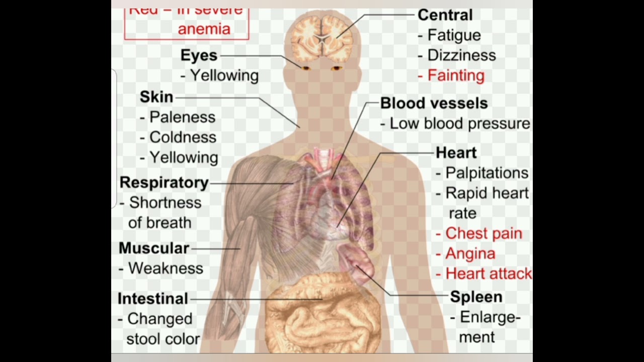 Анемия и вес. Симптомы низкого ферритина. Болезни крови симптомы. Клиническая картина анемии.