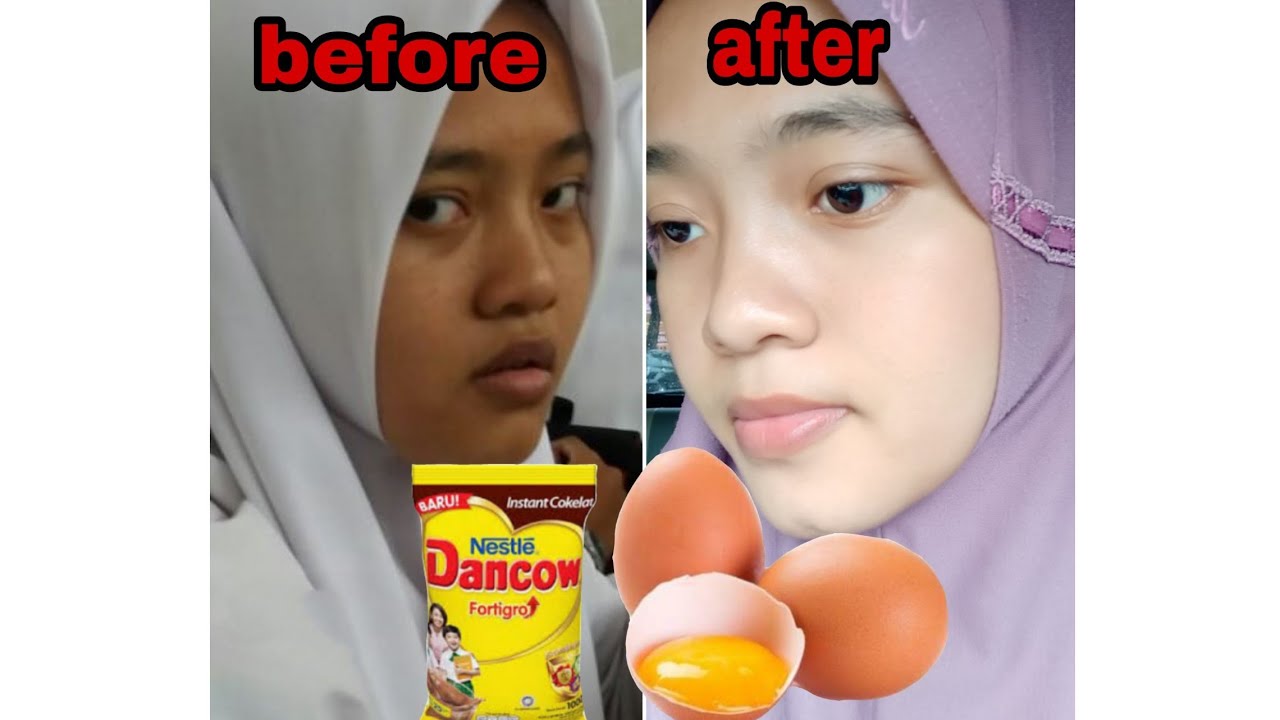 Bandingin Masker Tepung Beras Vs Masker Susu Dancow Tips Bikin Putih Semalam Youtube
