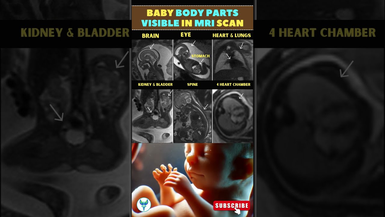 Pregnancy Scan Fetal Development Stages Baby Body Parts MRI Images Shortsfeed