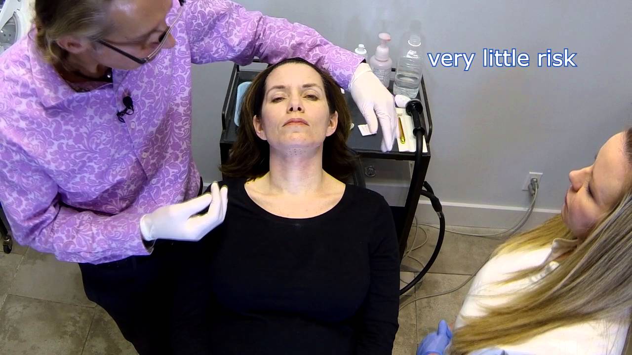 Kybella for Removing Double Chin Fat