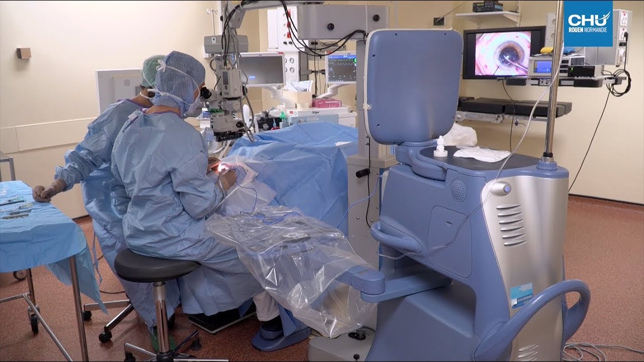 Cataracte la chirurgie au laser YouTube Cataracte la chirurgie au laser YouTube