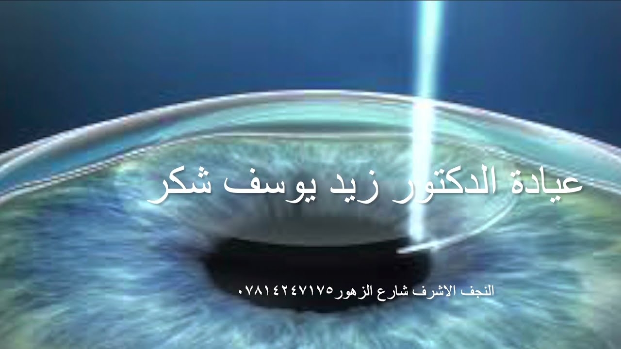 عملية الفيمتوسمايل لتصحيح النظر | بديل النظارة | د زيد يوسف شكر | النجف