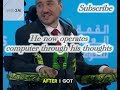 Noland Arbaugh, the first human recipient of a Neuralink brain implant