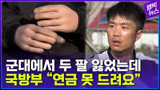 군대에서 두 팔 잃었는데 국방부는 “연금은 늦어서 못준다”