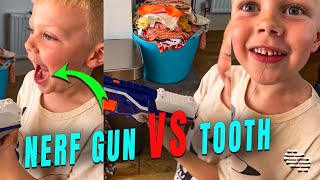 6 Year Old Use a Nerf Gun to Remove His First Tooth