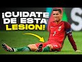 LA LESIÓN QUE ATERRORIZA A TODOS LOS FUTBOLISTAS - PUBALGIA FUTBOL