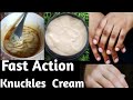 How To Make Fast Action Dark Knuckles And Areas Cream