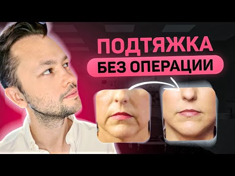 Видео: Как подтянуть овал без операции