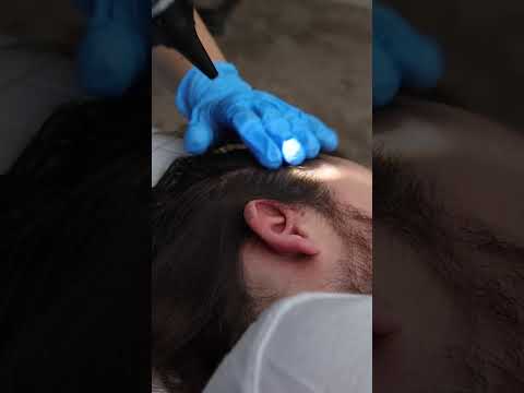 ASMR Real Person Scalp Check & Hair Touching (Soft Spoken Medical Exam) Unintentional ASMR Roleplay