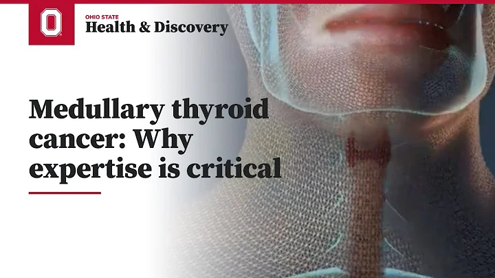 Medullary thyroid cancer: Why expertise is critical | Ohio State Medical Center
