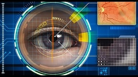 Diabetic retinopathy Detection