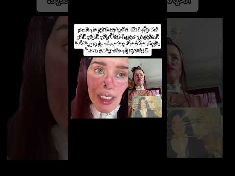 فتاة تتعافى تدريجي ا من سحر مدفون دام لسنوات بعد حملة تنظيف المقابر في الجزائر ترند الجزائر