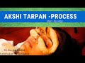 Netra tarpan process  step by step process eye nourishing  panchakarma treatment