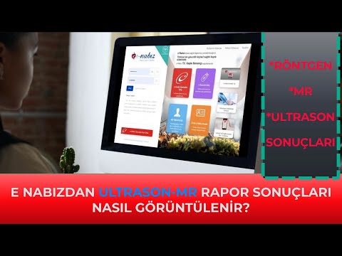 Video: Röportajın Sonuçları Nasıl öğrenilir