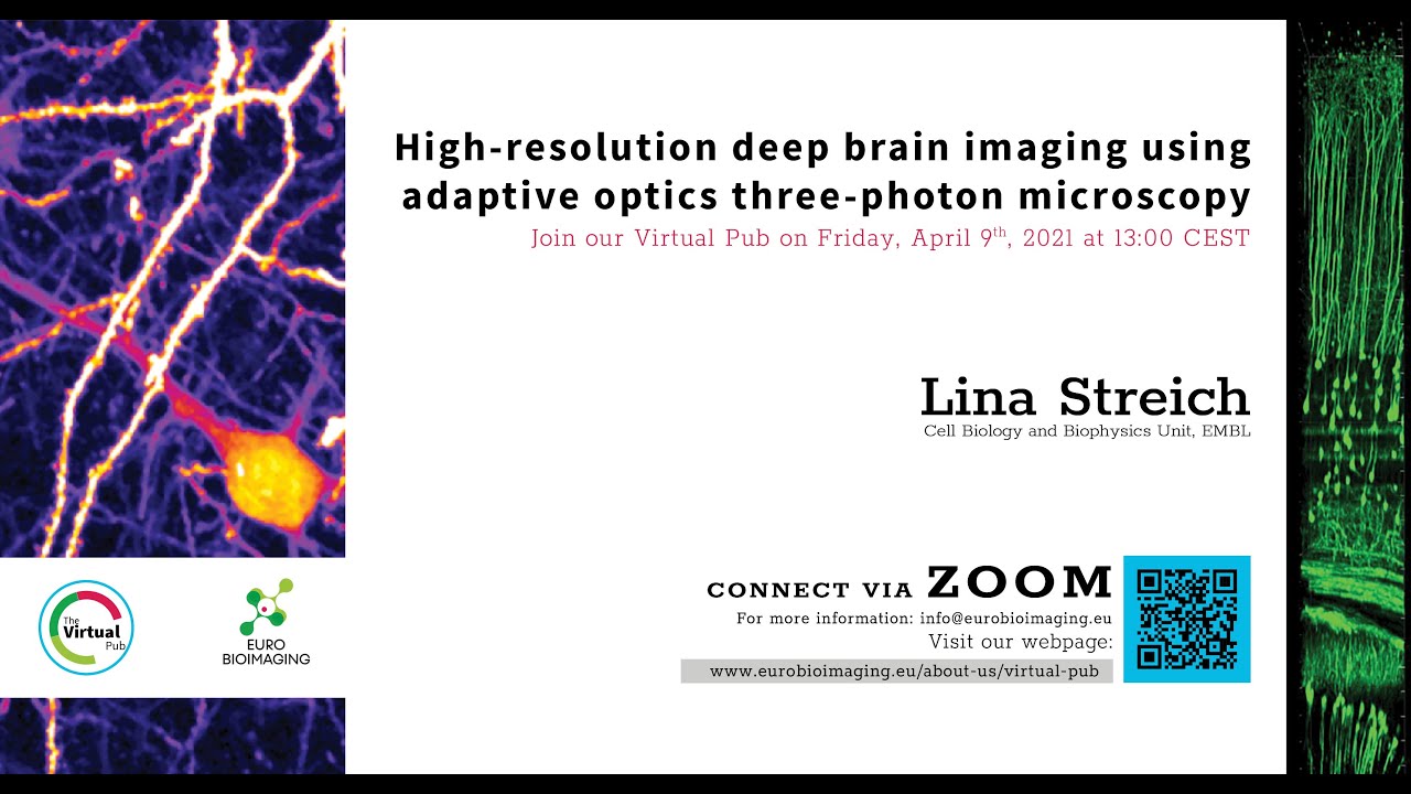 Virtual Pub: "High resolution deep brain imaging using adaptive optics three-photon microscopy"