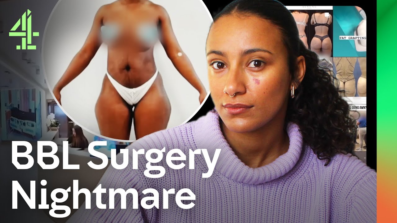 The Truth About Brazilian Butt Lifts: Botched Surgery Exposed (2024)