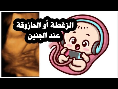 فيديو: لماذا يصاب الجنين بالفواق؟