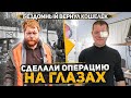 8 лет не видел на левый глаз. Сделали операцию парню который вернул кошелёк с деньгами. Как прошло?